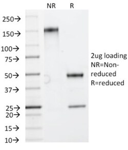 HSP27 Antibody (HSPB1/774), Novus Biologicals 0.2mg; Unlabeled:Antibodies,